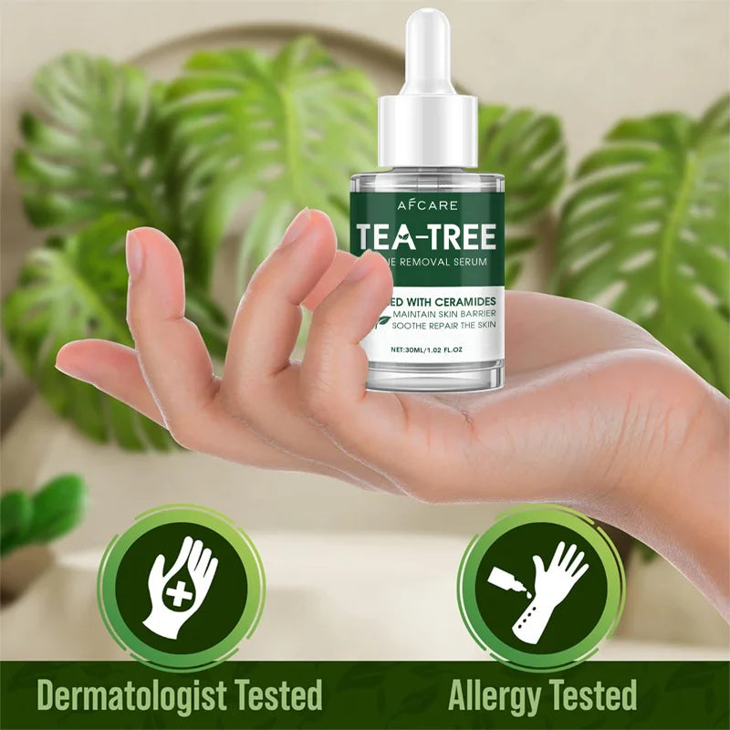 Tea Tree Acne Treatment Serum for Oil Control and Redness Relief