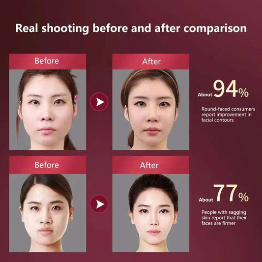 LED Photon Therapy Facial Slimming Vibration Massager Facial Lifting Device