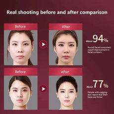 LED Photon Therapy Facial Slimming Vibration Massager Facial Lifting Device