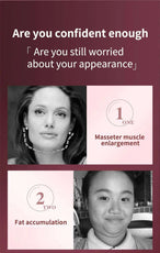 LED Photon Therapy Facial Slimming Vibration Massager Facial Lifting Device