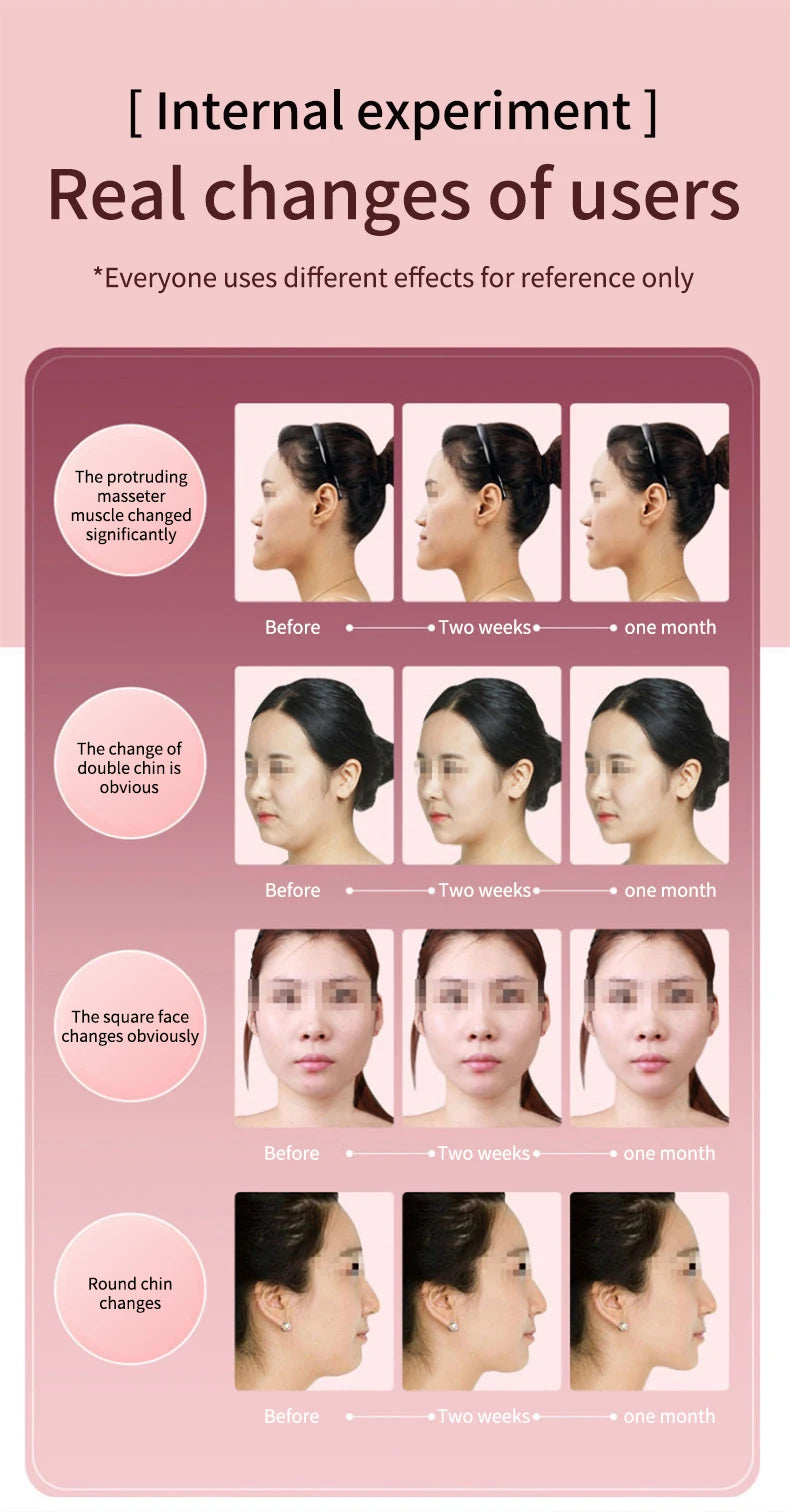 LED Photon Therapy Facial Slimming Vibration Massager Facial Lifting Device