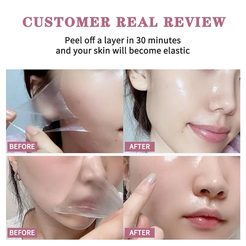 AFCARE Skin Treatment with Peel-Off Layer for Improved Elasticity and Moisture, Before and After Results