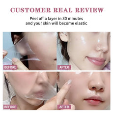 AFCARE Skin Treatment with Peel-Off Layer for Improved Elasticity and Moisture, Before and After Results