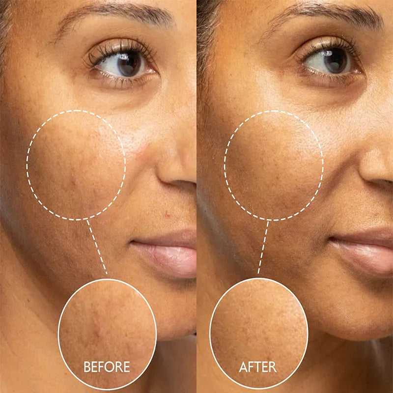 AFCARE Skin Treatment Before and After Results Showing Clearer, Smoother Skin Texture