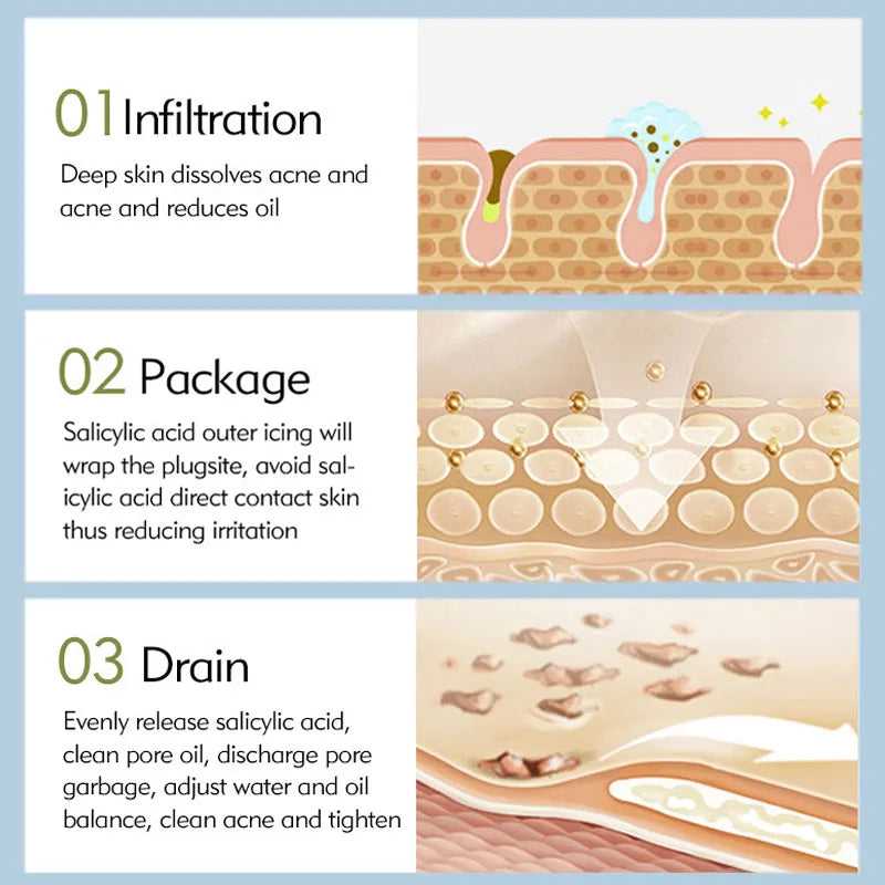 AFCARE Acne Treatment Steps: Infiltration, Package, and Drain for effective acne relief