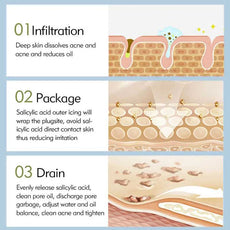 AFCARE Acne Treatment Steps: Infiltration, Package, and Drain for effective acne relief