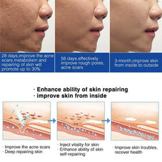 AFCARE Skin Treatment Process Showing Improvement of Acne Scars and Skin Repair Over Time