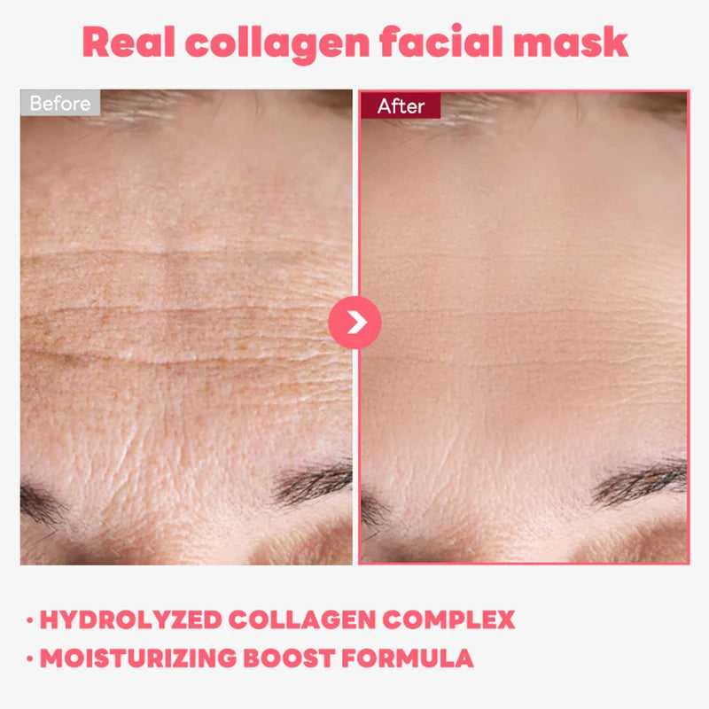 AFCARE Real Collagen Facial Mask Before and After Results Showing Smoother Skin and Reduced Wrinkles