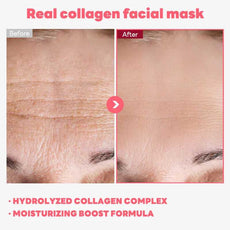 AFCARE Real Collagen Facial Mask Before and After Results Showing Smoother Skin and Reduced Wrinkles