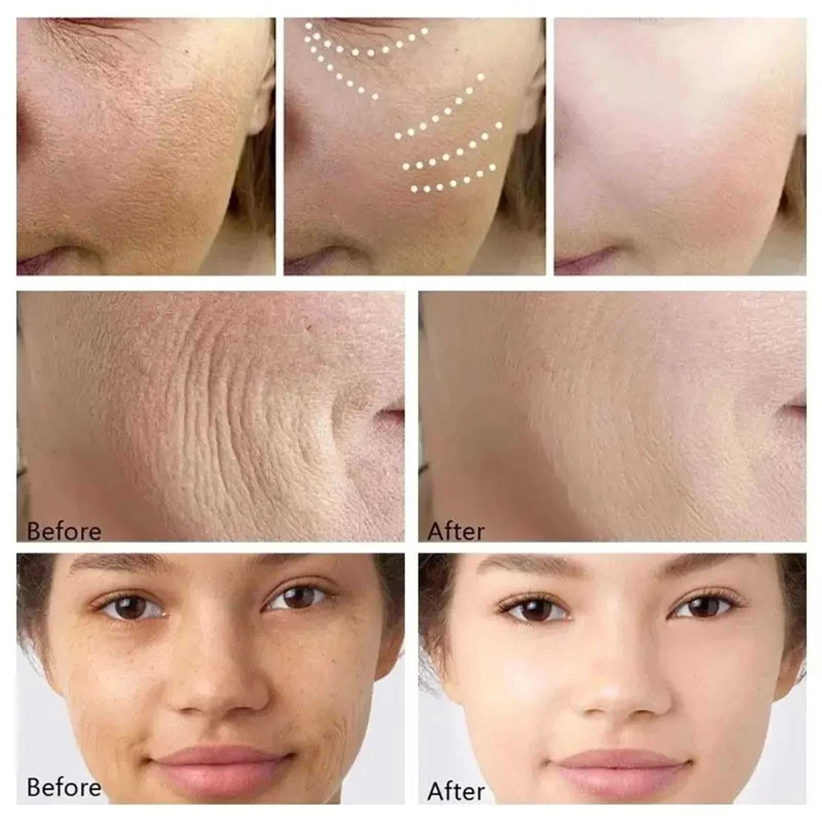 eelhoe Anti-Aging Facial Masks Showing Before and After Results for Smoother Skin