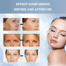 eelhoe Facial Mask Before and After Use Showing Significant Skin Improvement and Refreshing Results