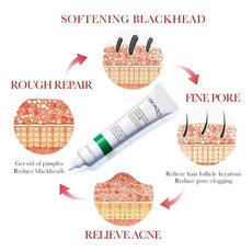 SAKSRAAR Blackhead Treatment Cream for Relieving Acne and Reducing Pore Clogging