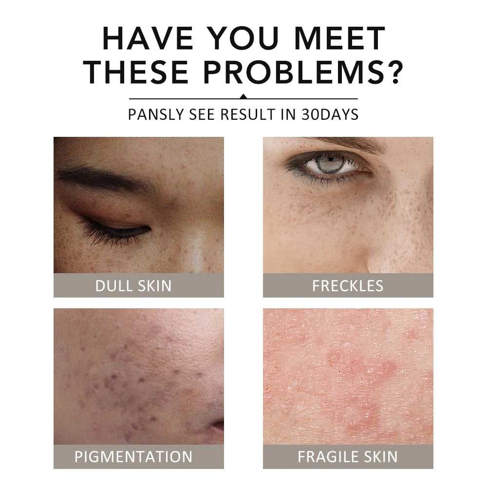 Ms.Dear Facial Masks for Dull Skin, Pigmentation, Freckles, and Fragile Skin Solutions