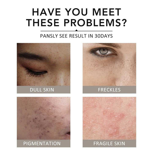 Ms.Dear Facial Masks for Dull Skin, Pigmentation, Freckles, and Fragile Skin Solutions