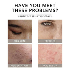 Ms.Dear Facial Masks for Dull Skin, Pigmentation, Freckles, and Fragile Skin Solutions