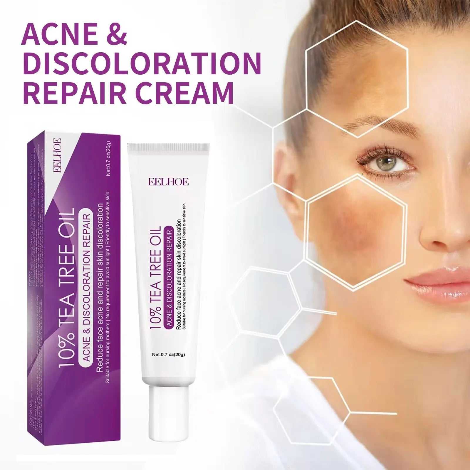 EELHOE 10% Tea Tree Oil Acne and Discoloration Repair Cream for Clearer Skin