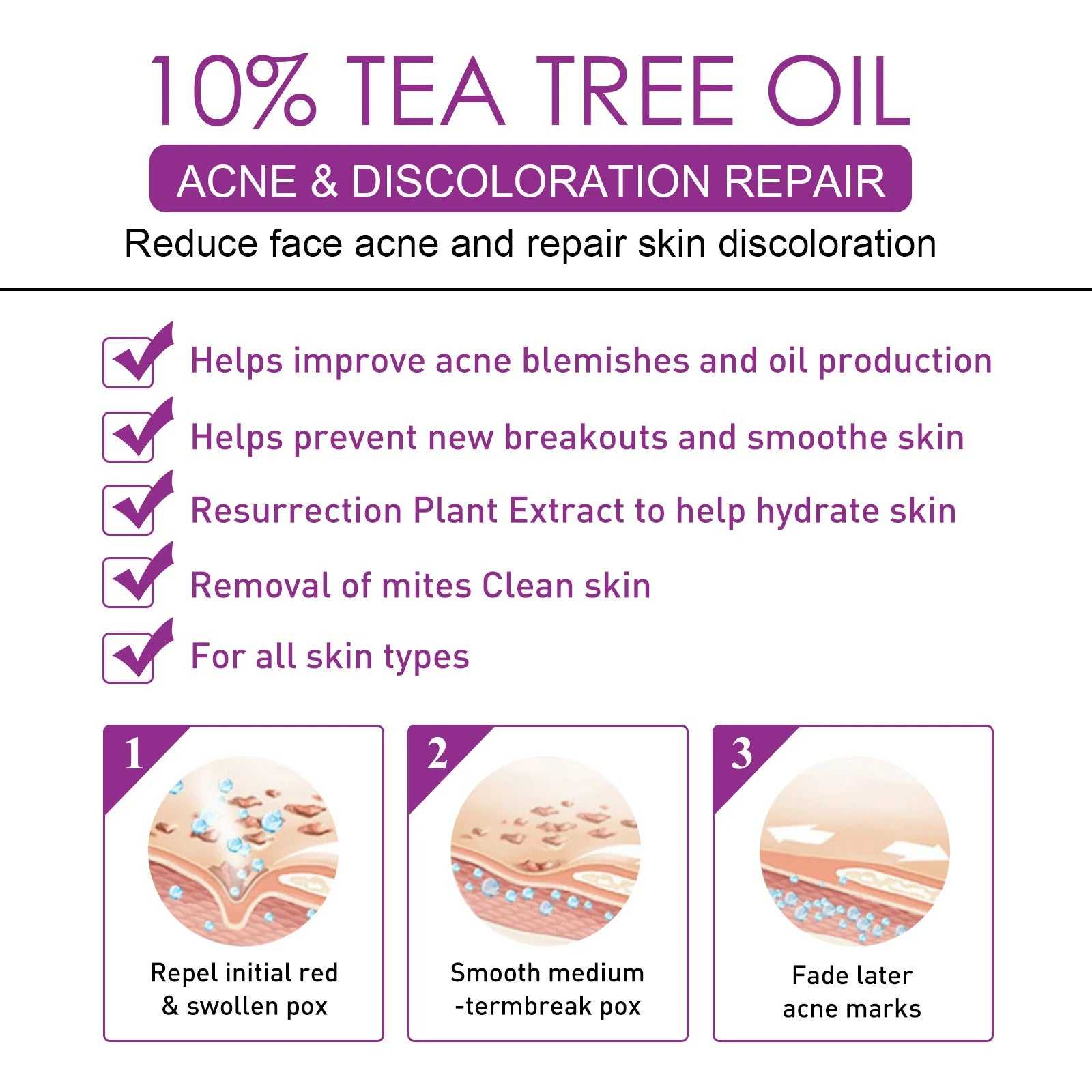 EELHOE 10% Tea Tree Oil Treatment for Acne and Discoloration with Hydration Benefits