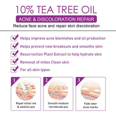 EELHOE 10% Tea Tree Oil Treatment for Acne and Discoloration with Hydration Benefits