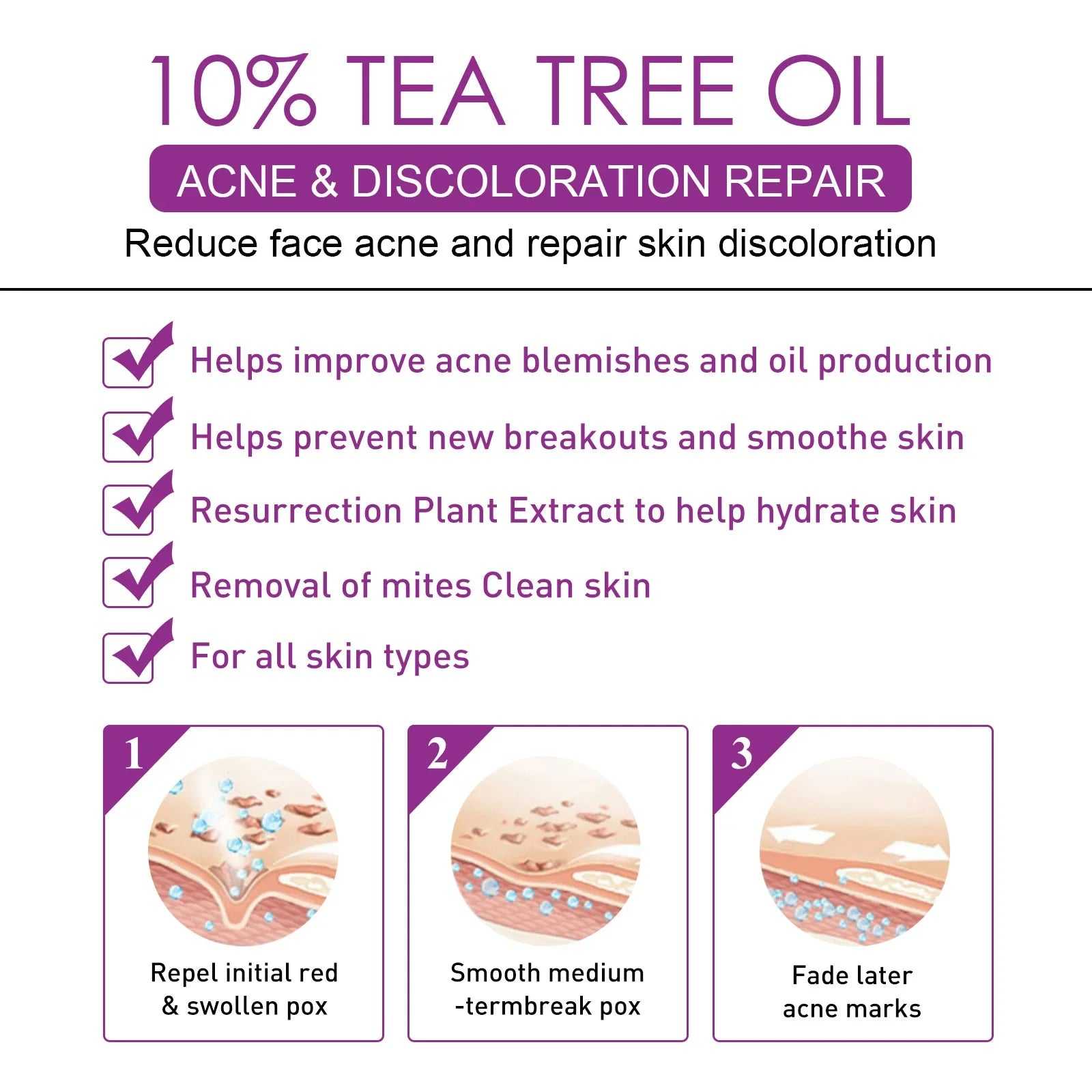 EELHOE 10% Tea Tree Oil Treatment for Acne and Skin Discoloration with hydrating properties