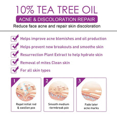 EELHOE 10% Tea Tree Oil Treatment for Acne and Skin Discoloration with hydrating properties