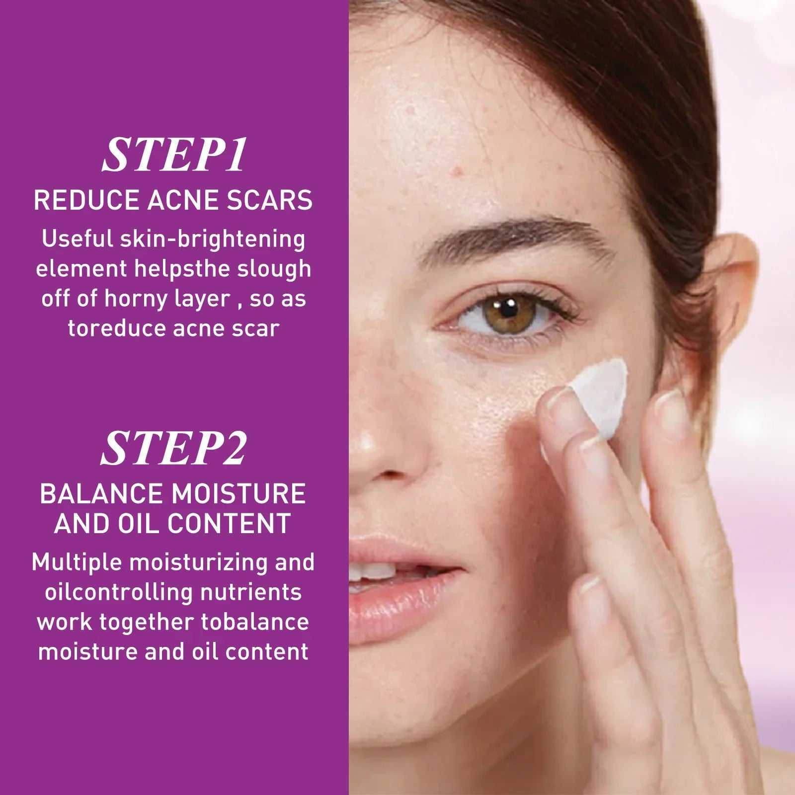 EELHOE Acne Treatment Steps with Focus on Reducing Scars and Balancing Moisture and Oil