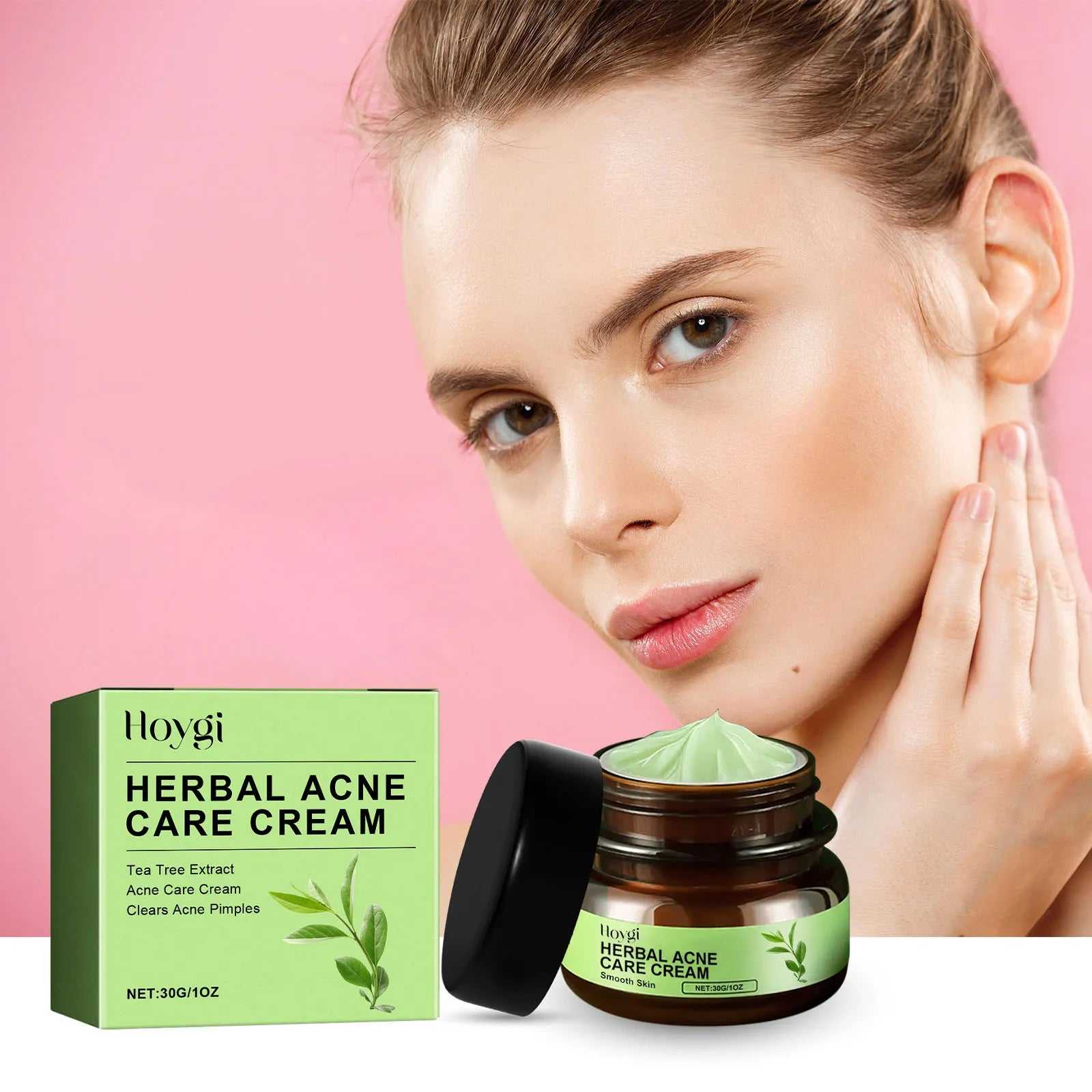 Hoygi Herbal Acne Care Cream with Tea Tree Extract in a jar for treating and cleaning acne pimples