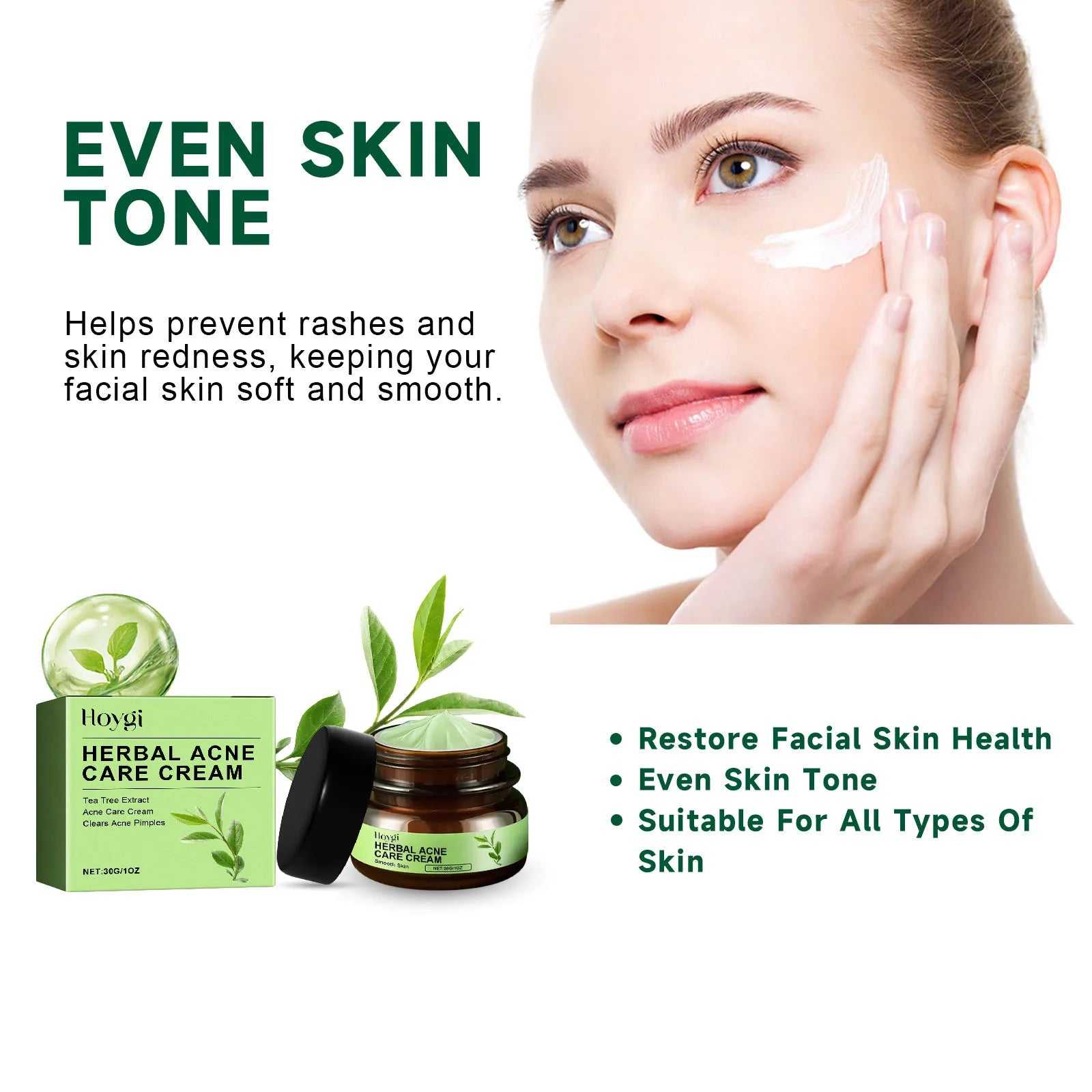 Hoygi Herbal Acne Care Cream for Even Skin Tone and Smooth Texture, suitable for all skin types