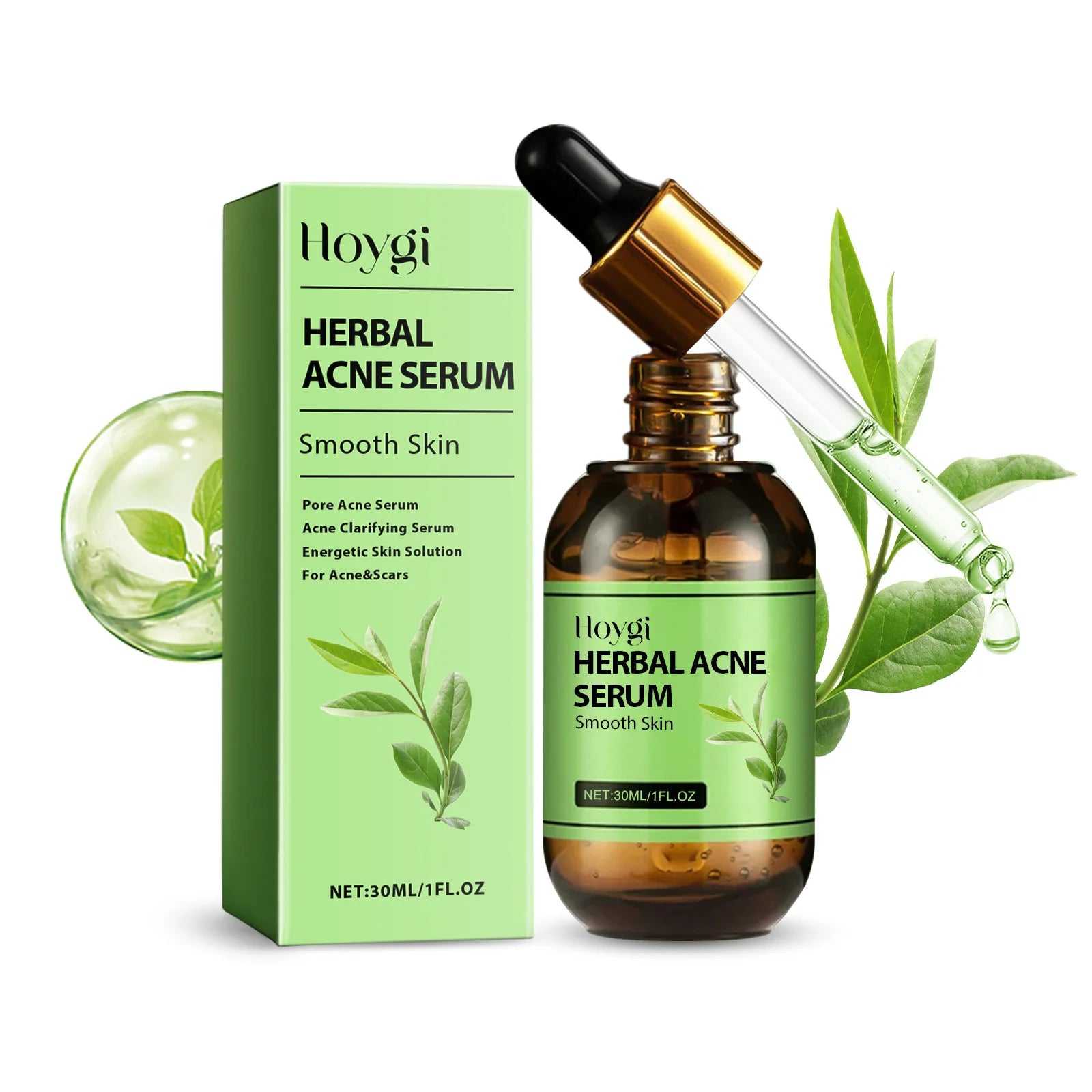 Hoygi Herbal Acne Serum in 30ml bottle for smooth skin and acne treatment with dropper included