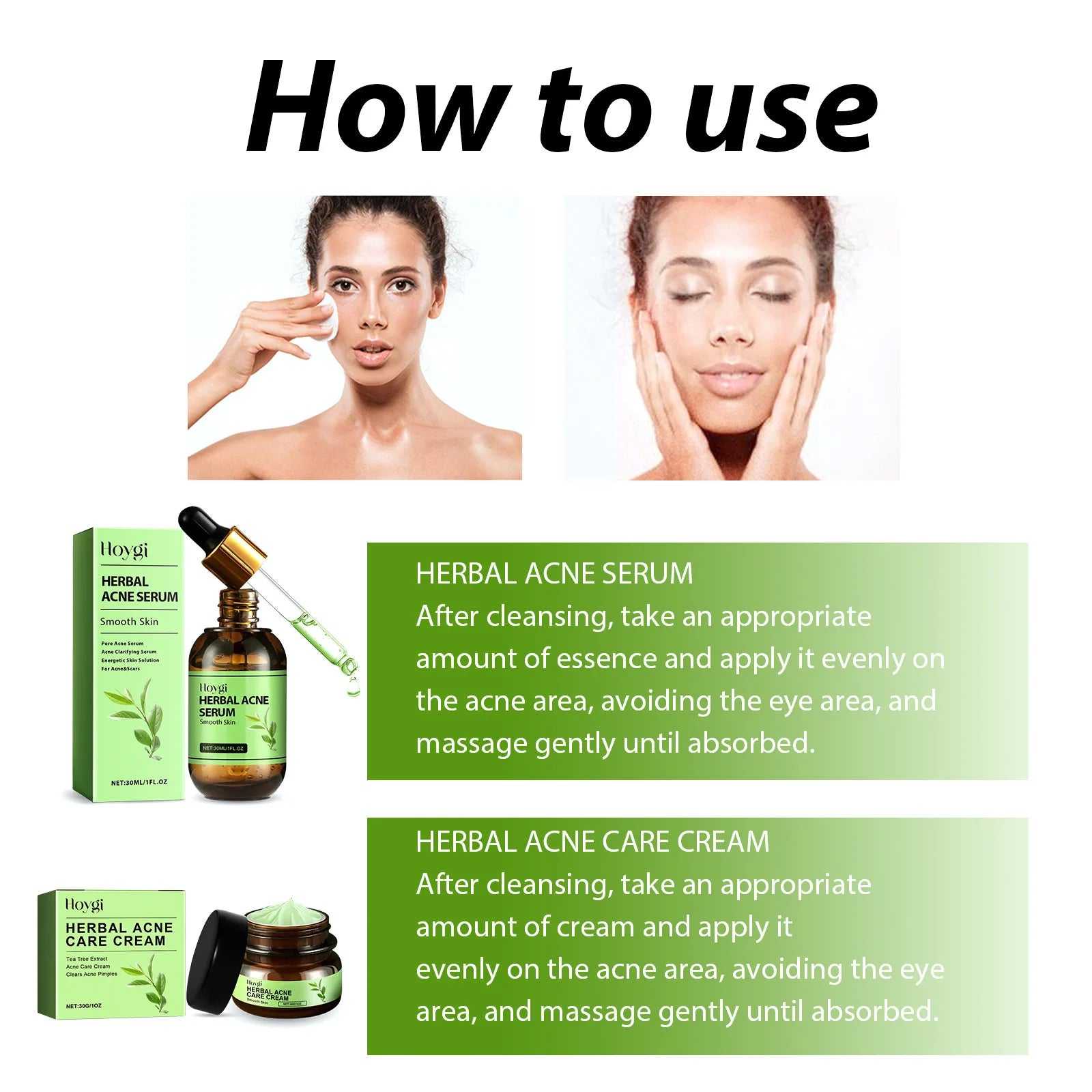 Hoygi Herbal Acne Serum and Care Cream usage instructions for clear skin