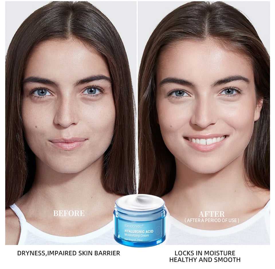 Before and after photo showing results of ibcccndc hyaluronic acid cream moisturizer for healthy, smooth skin