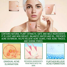 jaysuing salicylic acid acne serum for gradual acne elimination and scar relief, featuring natural plant extracts