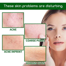 Image showcasing skin issues including acne and coarse pores promoting salicylic acid acne serum for treatment