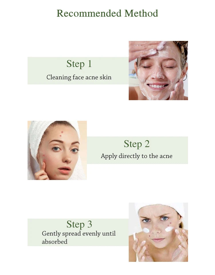 JoyPrettyin Acne Treatment Method Steps with Skin Care Instructions for Clearer Skin