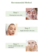 JoyPrettyin Acne Treatment Method Steps with Skin Care Instructions for Clearer Skin