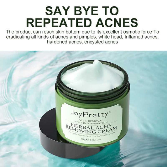 JoyPretty Herbal Acne Removing Cream for treating pimples, whiteheads, and inflamed acne
