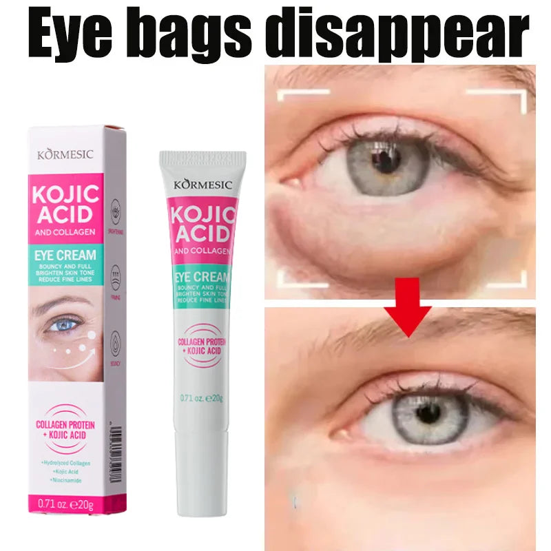 PWYUMAN Kojic Acid Eye Cream for Reducing Eye Bags with Collagen for Brightening Under-Eye Area