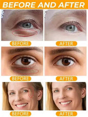PWYUMAN Eye Care Treatment Before and After Results Showing Reduced Puffiness and Dark Circles