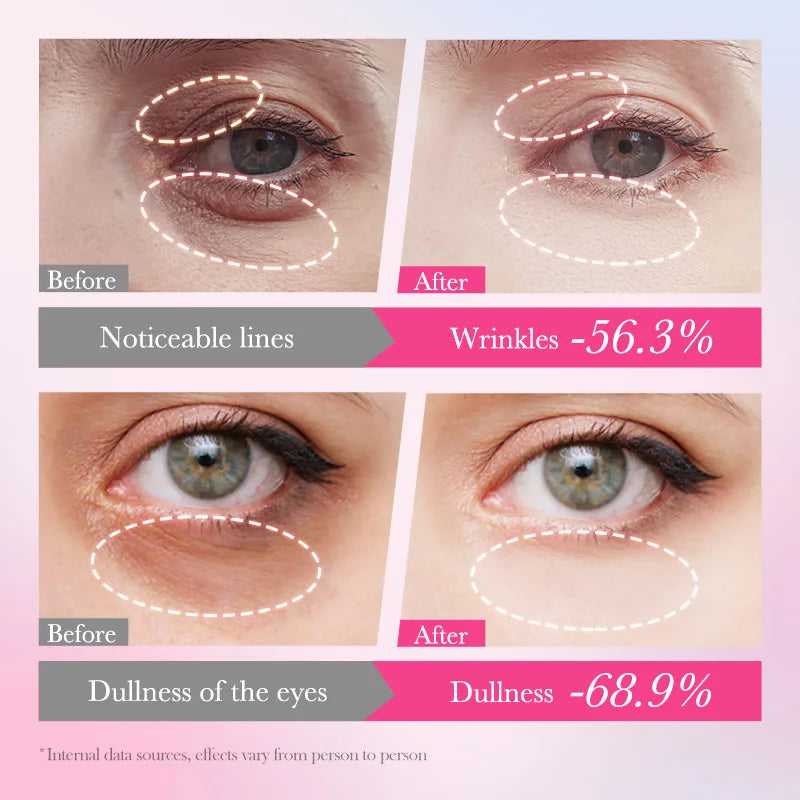 PWYUMAN Eye Care Results Before and After: Reduced Wrinkles by 56.3% and Dullness by 68.9%