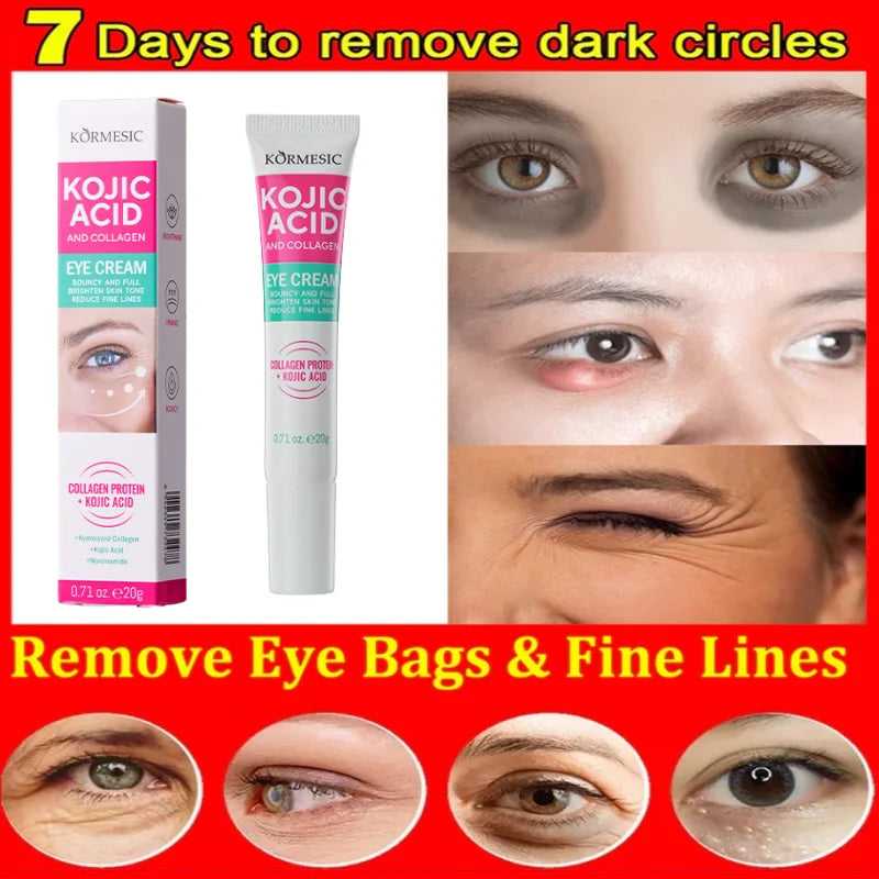 PWYUMAN Kojic Acid Eye Cream for Dark Circles, Bags, and Fine Lines, Effective in 7 Days