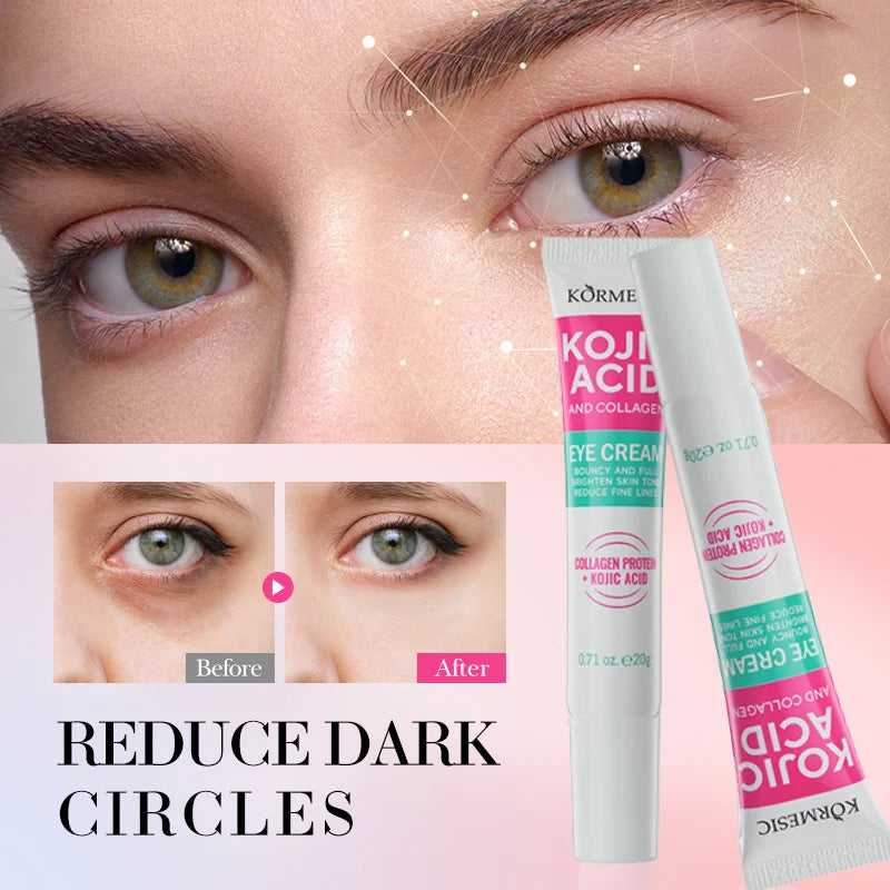 PWYUMAN Kojic Acid Eye Cream for Reducing Dark Circles with Collagen and Hyaluronic Acid