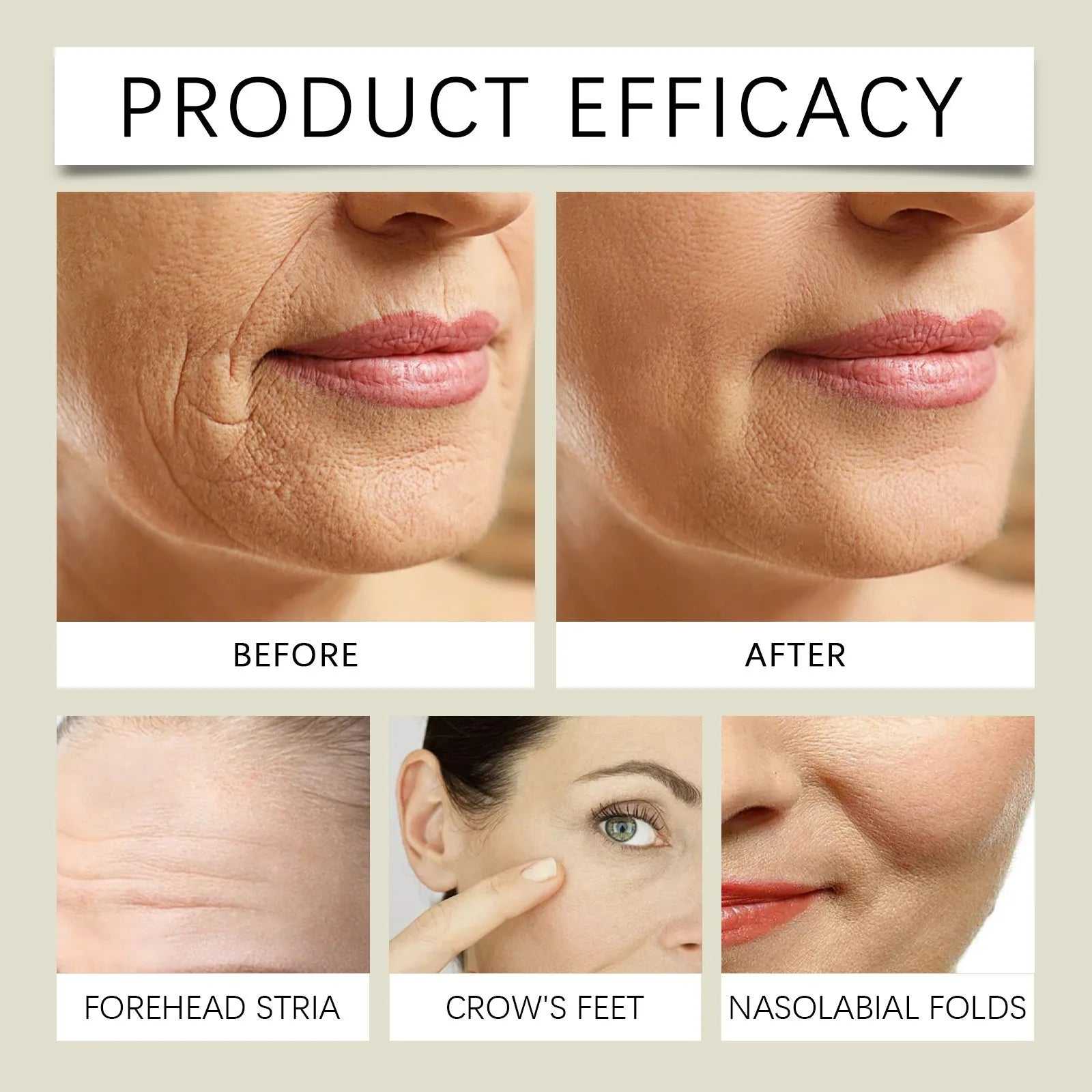 NoEnName_Null nourishing night cream before and after results for reducing forehead stria, crow's feet, and nasolabial folds