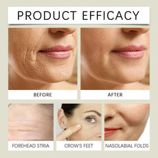 NoEnName_Null nourishing night cream before and after results for reducing forehead stria, crow's feet, and nasolabial folds