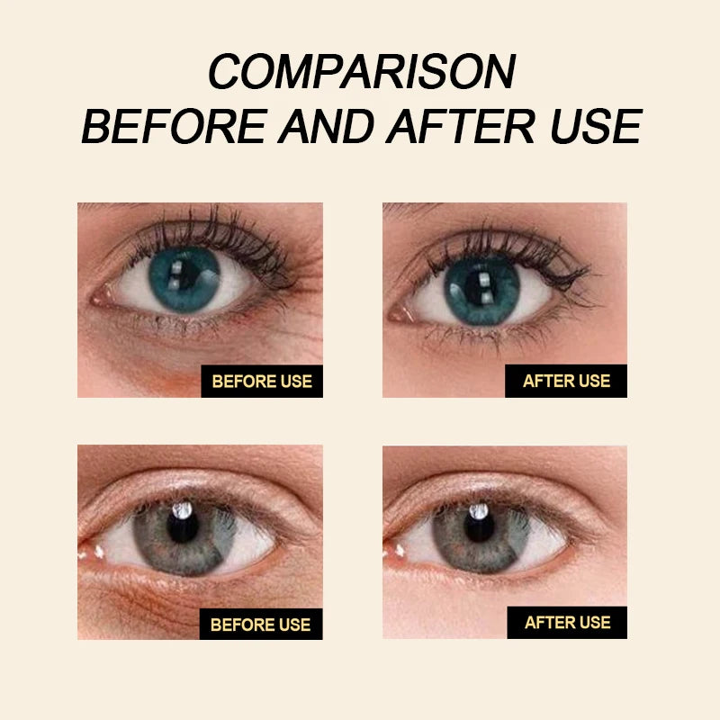 GULANXI Eye Care Product Before and After Comparison Showing Improved Eye Brightness and Clarity