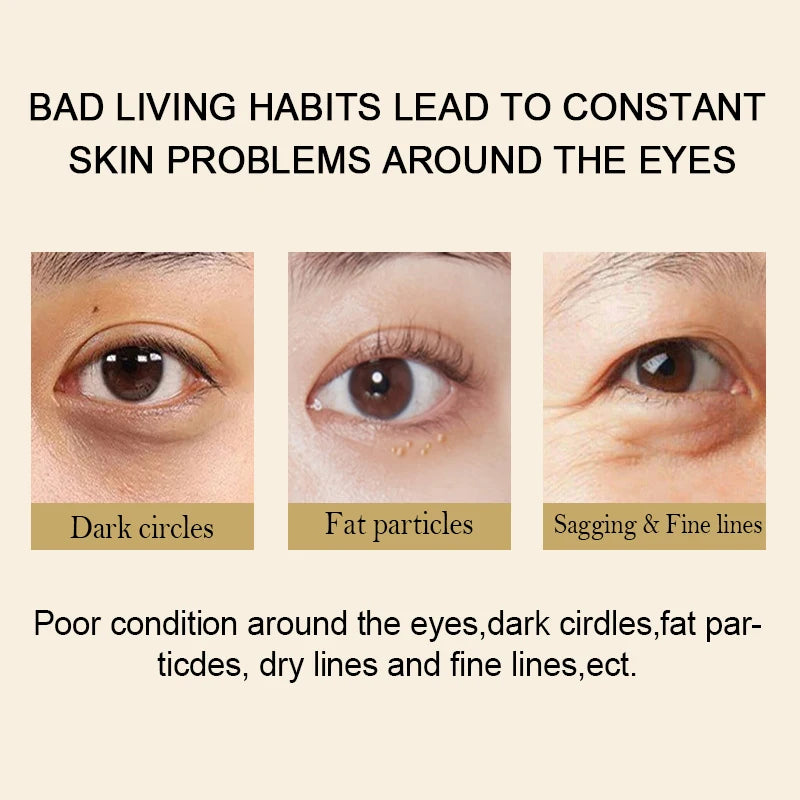 GULANXI Eye Care with images showing dark circles, fat particles, and fine lines around the eyes