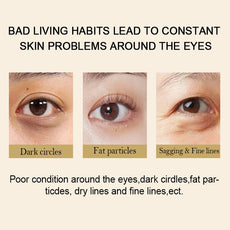 GULANXI Eye Care with images showing dark circles, fat particles, and fine lines around the eyes