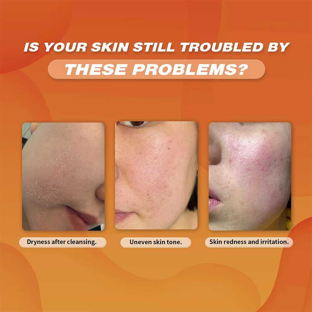 Ms.Dear Cleansers addressing dry skin, uneven tone, and irritation for effective skincare solutions