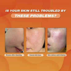 Ms.Dear Cleansers addressing dry skin, uneven tone, and irritation for effective skincare solutions