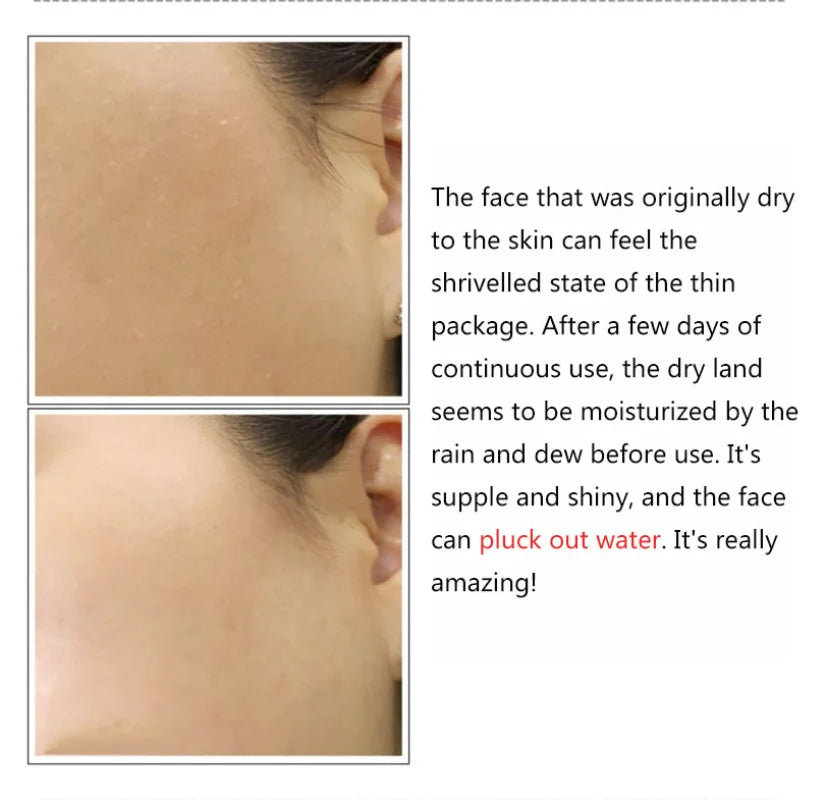 LANBENA hydrating hyaluronic acid serum shown on dry skin, demonstrating hydration and improved skin texture